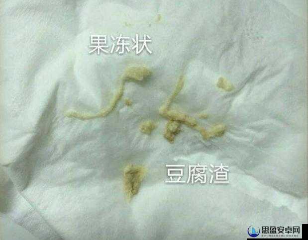 女生次数多了是否会出现豆腐渣分泌物呢